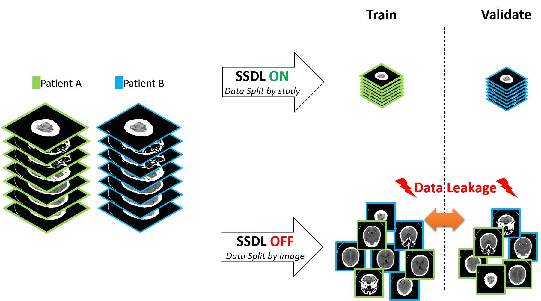 SSDL prevents data leakage in sequential images through "split by study"